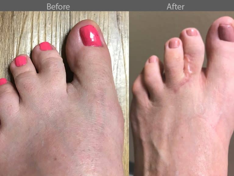 Case Studies Bregman FootAnkle & Nerve Center